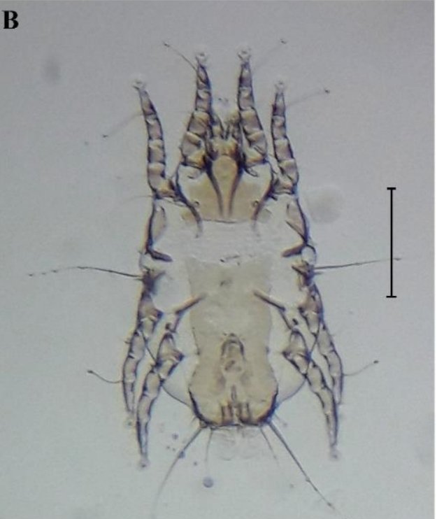 acarological's tweet photo. New records of feather mites (Sarcoptiformes: Astigmata) from some birds in Türkiye
https://t.co/Smq4mAwApD #acari #mite #astigmata https://t.co/kVKvfsHn46