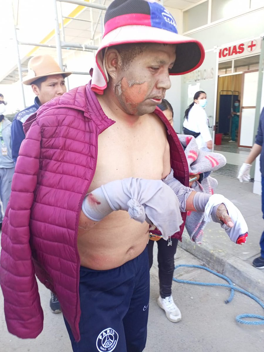 MamaniZenobia's tweet photo. #ÚLTIMO
Aproximadamente a las 11:30 de este domingo, se registró un incendio en una vivienda de la zona San Felipe de Seke, en la avenida Radial, en #ElAlto. Producto de este hecho, tres personas resultaron con quemaduras y fueron auxiliadas al Hospital del Norte. https://t.co/dToETcH4wF