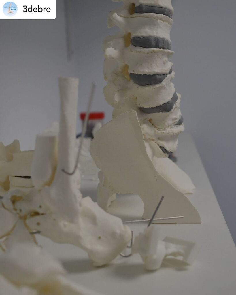 3dheals's tweet image. #repost @3debre #anatomicalmodel #medical3dprinting #medicalsimulation #surgicalplanning 
.
.
📸 @ritamtnzc instagr.am/p/CvnOMhwvJxV/