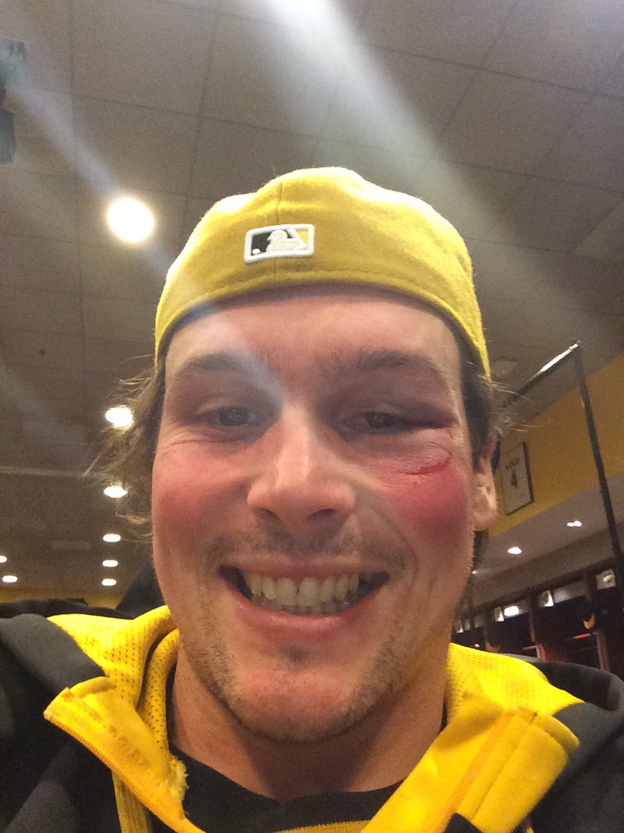 Lunchboxhero45's tweet photo. Don’t drop your gloves in an @mlb bench clearing brawl unless you are ready to get hit!! @Pirates @Brewers @RealCarlosGomez #maldonado #shiner https://t.co/4cHWOhB5F2
