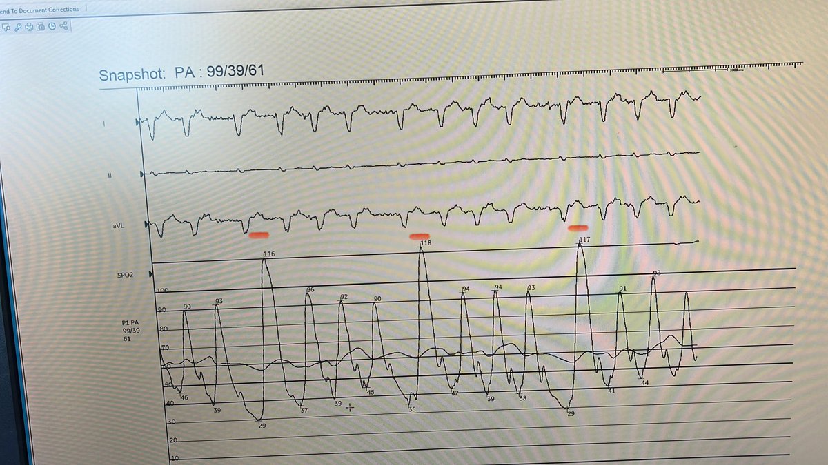 Ajay V. Srivastava MD tweet media