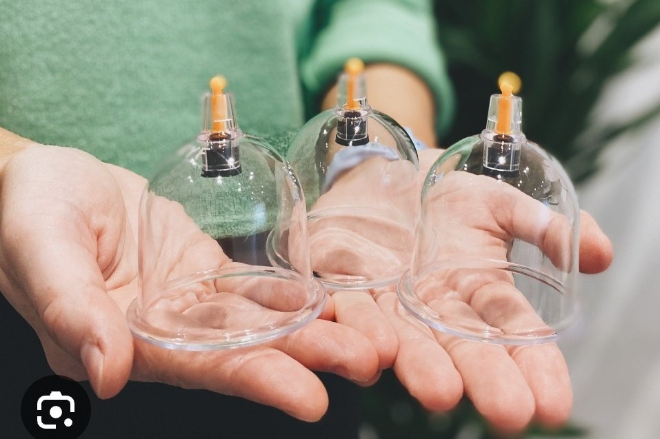 princesnothman's tweet photo. Hijama is an excellent way to remove the toxic waste from the blood stream, and the results will obviously be a healthy and properly functioning body. https://t.co/88iwCkB0q5