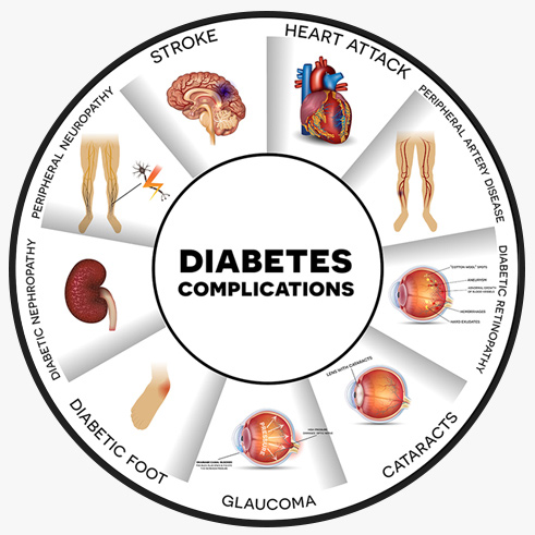 diabetes_clin's tweet photo. Submit your article on #Diabetic #eye #disease: It occurs when #retina get #damage due to #Diabetes. In which it leads to #blurred vision, #fluctuating vision, #impaired color vision, etc.
Article submission link: https://t.co/kEDtxlSBjf
Deadline for submission 20 August, 2023. https://t.co/GrmKg4uF4p