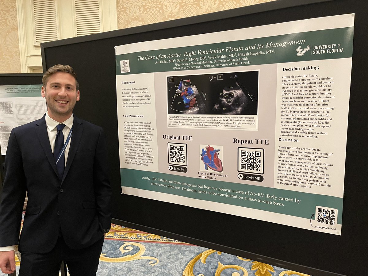 hadar_ari's tweet photo. Great weekend at Florida ACC! Excellent education, inspiring research, and an introduction to the future of cardiology (like AI in cardiology ☄️)
I was honored to share a case of an Ao-RV fistula with @BradMoney6 and  interact with our incredible cardiology community at FLACC https://t.co/v3NjFo5jDb