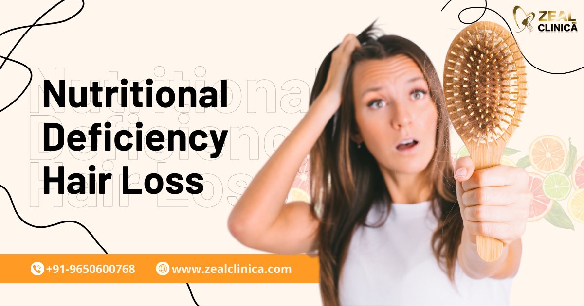 ZealClinica's tweet photo. Join us🤗 as we dive into the world of #NutritionalDeficiencyHairLoss, exploring the essential vitamins and nutrients your locks crave for vitality and shine.🌟
#nutritiondeficiency #hairfall #hairloss #hairtreatment #vitamin #nutrition #homeremedies #hairgrowth #regrowth #hair https://t.co/7rj6UeGO7Y