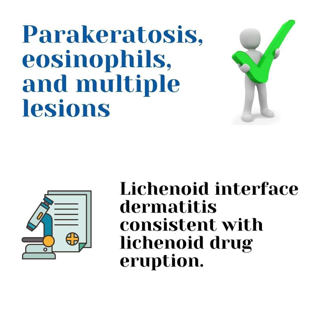 Do you have a case of lichenoid dermatitis? Watch this step-by-step... Did you like it?
 You can check more tips in the skin section of the Pathplus.app
.
#pathplus #pathology #dermpath