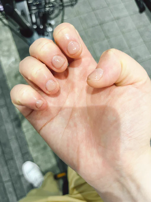 俺の爪、2ヶ月でめちゃくちゃキレイになった…… ずっと爪が可愛くなくて、写真撮る時とか見せられなかったんだけど、ようやく自信もって映せる