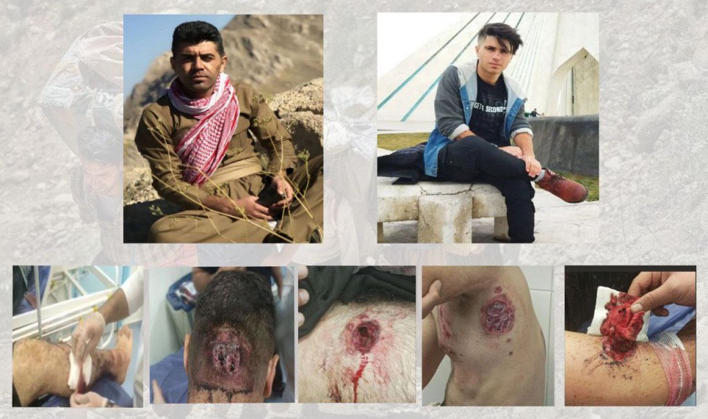 Kolbarnews_En's tweet photo. #Iran #Kurdistan
❗️Nine kolbars were injured in Nousud border area.
According to Kolbarnews, on the evening of Sunday, August 6, border forces opened fire on a group of #kolbars in #Nousud border area, resulting in severe #injuries to nine kolbars from the cities of #Javanroud, #Salas_Babajani and #Paveh.
As of the time of compiling this report, the identities of six of these kolbars have been confirmed as #Ehsan_Rasouli from Paveh, #Salam_Vissi, #Milad_Bazani, #Nima_Azami, and #Houshiar_Bazani from Javanroud, and #Farshad (last name unknown) from Salas Babajani, according to Kolbarnews.
Most of these kolbars have injuries to the #head, #back, #hands and #feet. Ehsan Rasouli suffered #chest injuries and underwent surgery at Qods Hospital in Paveh.
Based on this report, the injured kolbars were transferred to Qods Hospital in Paveh for treatment, and the general condition of several of them is reported to be critical.
#Kolbarnews
#JinaAmini
#MahsaAmini
#protest
