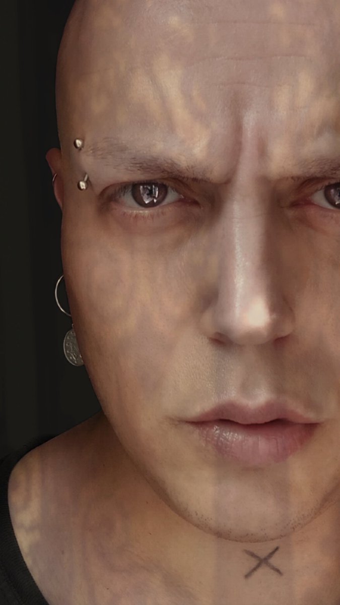 Bi gün buraya (Barış 3-0 Kanser) skorunu yazacağım. Az kaldı!