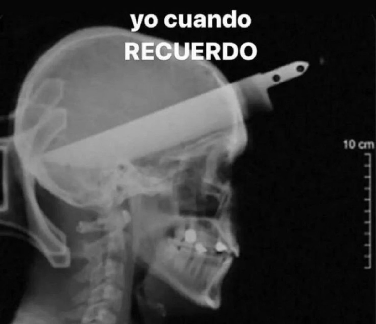 skereunpesado's tweet image. 