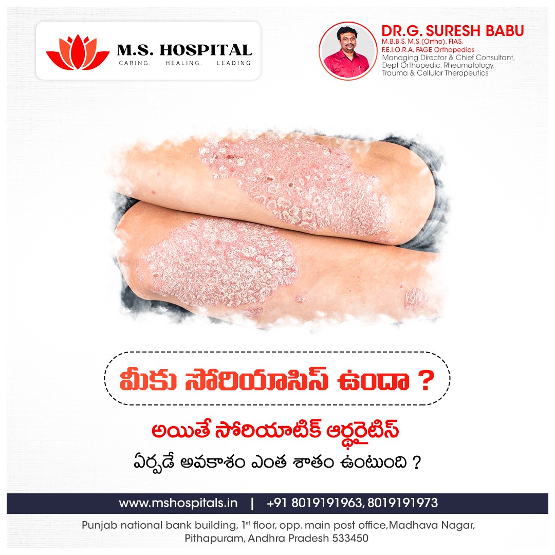 For all your #Emergency and #CriticalCare needs #MSHospitals in #Pithapuram is fully equipped to deal with your #MedicalConditions 24/7 Visit website: mshospitals.in Or call for appointments: Or call for appointments: +91 80 19 19 19 63,