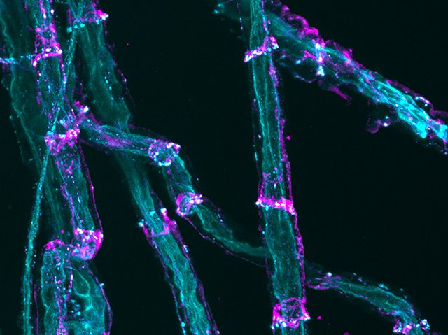 Biomedical Picture of the Day BPoD (@bpod_s) on Twitter photo αTcat protein found at Schwann #cell junctions of peripheral and #centralnervoussystems using a novel fluorescent reporter mouse model. Image & research by <a href="/AntheaWen/">Anthea Wen</a> & <a href="/ErikR18/">Erik Rabin</a> et al <a href="/GottardiLab/">Gottardi Lab</a> <a href="/NUFeinbergMed/">Northwestern Feinberg School of Medicine</a> in <a href="/BiologyOpen/">Biology Open</a> <a href="/Co_Biologists/">The Company of Biologists</a>. On bpod.mrc.ac.uk/archive/2023/8… αTcat protein found at Schwann #cell junctions of peripheral and #centralnervoussystems using a novel fluorescent reporter mouse model. Image & research by <a href="/AntheaWen/">Anthea Wen</a> & <a href="/ErikR18/">Erik Rabin</a> et al <a href="/GottardiLab/">Gottardi Lab</a> <a href="/NUFeinbergMed/">Northwestern Feinberg School of Medicine</a> in <a href="/BiologyOpen/">Biology Open</a> <a href="/Co_Biologists/">The Company of Biologists</a>. On bpod.mrc.ac.uk/archive/2023/8…