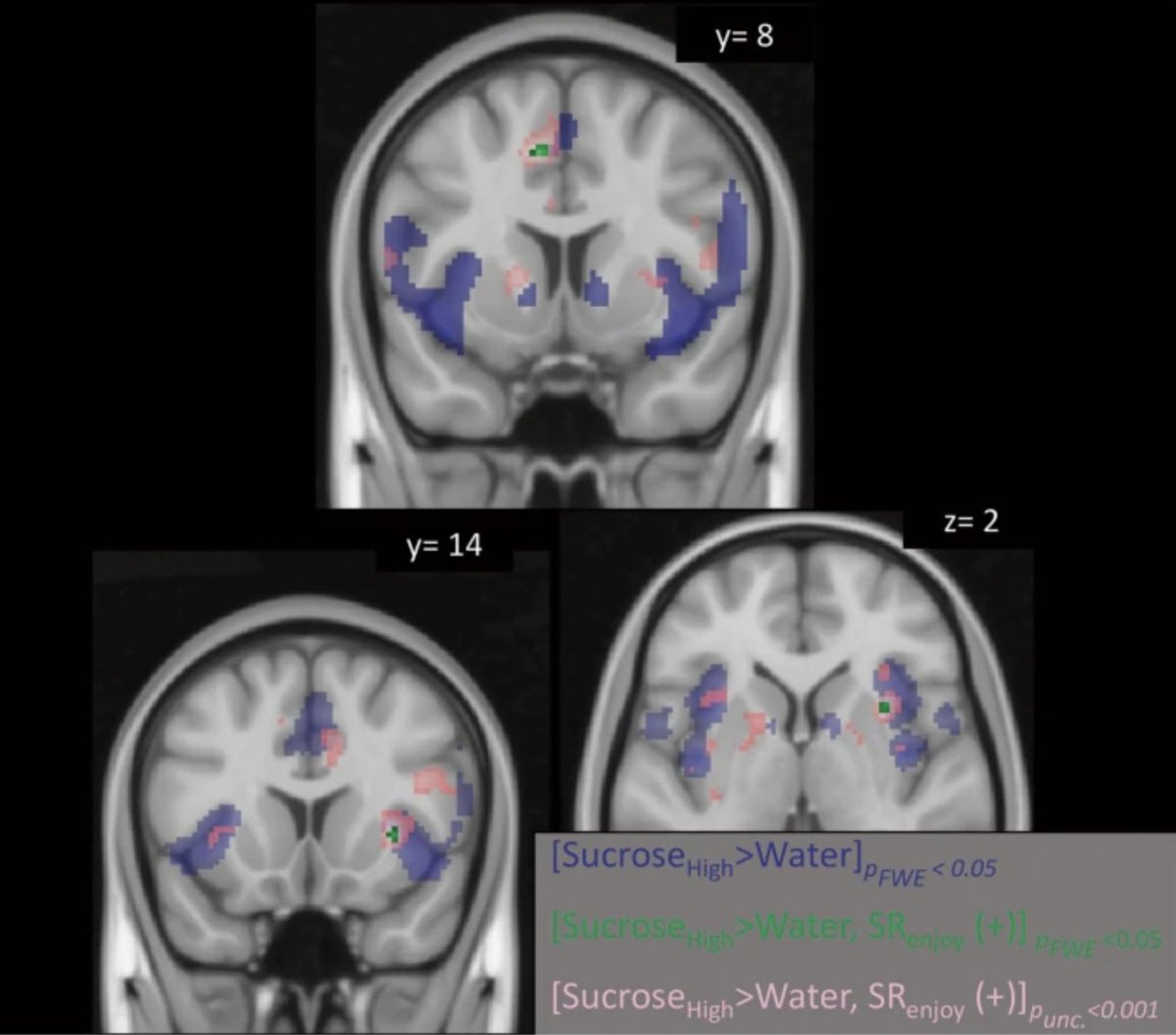 New in <a href="/npp_journal/">Neuropsychopharmacology</a>, "High-intensity sweet taste as a predictor of subjective alcohol responses to the ascending limb of an intravenous alcohol prime: an fMRI study"
nature.com/articles/s4138…