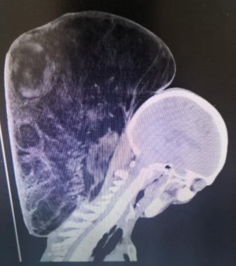 Oren Gottfried, MD tweet media