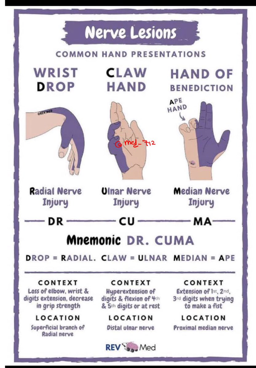 med_712's tweet photo. Nerve lesions https://t.co/BSHVGrUkJf