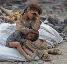 MohammedHojily's tweet photo. Reminder.
Miserable situation people of Yemen are experiencing, alomst 8 year of war and  Saudi blockade, produced Unemployment,  Disasters, widespread of epidemic, hunger could be famine, 2 third of population are relying on aids  and yet there is no signs of peace looming soon https://t.co/3tOjMJkmBK