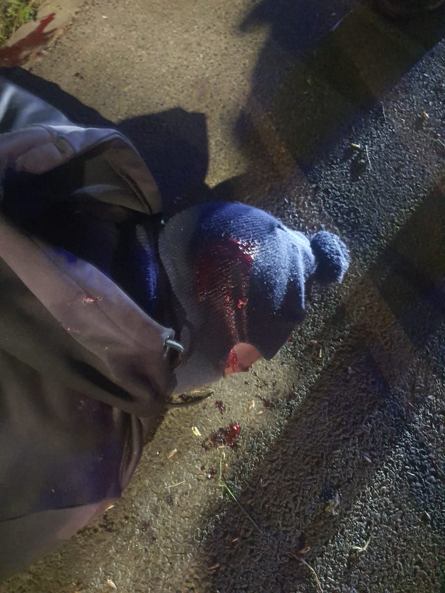 jenna_original's tweet photo. CAPE TOWN.  Apologies for the gruesome images. 

Police shot dead 2 taxi drivers and arrested 20 taxi drivers.

#TaxiStrike https://t.co/9EALVIkVQM