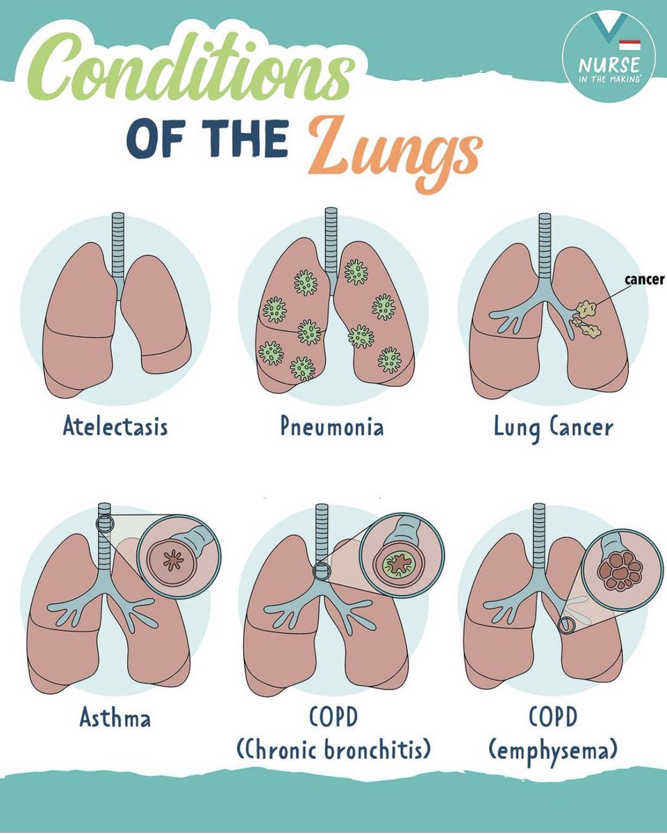 Nursing_888's tweet photo. .

 🔅 Conditions Of the Lungs 🫀🫁

. https://t.co/QHHLFeRDSe