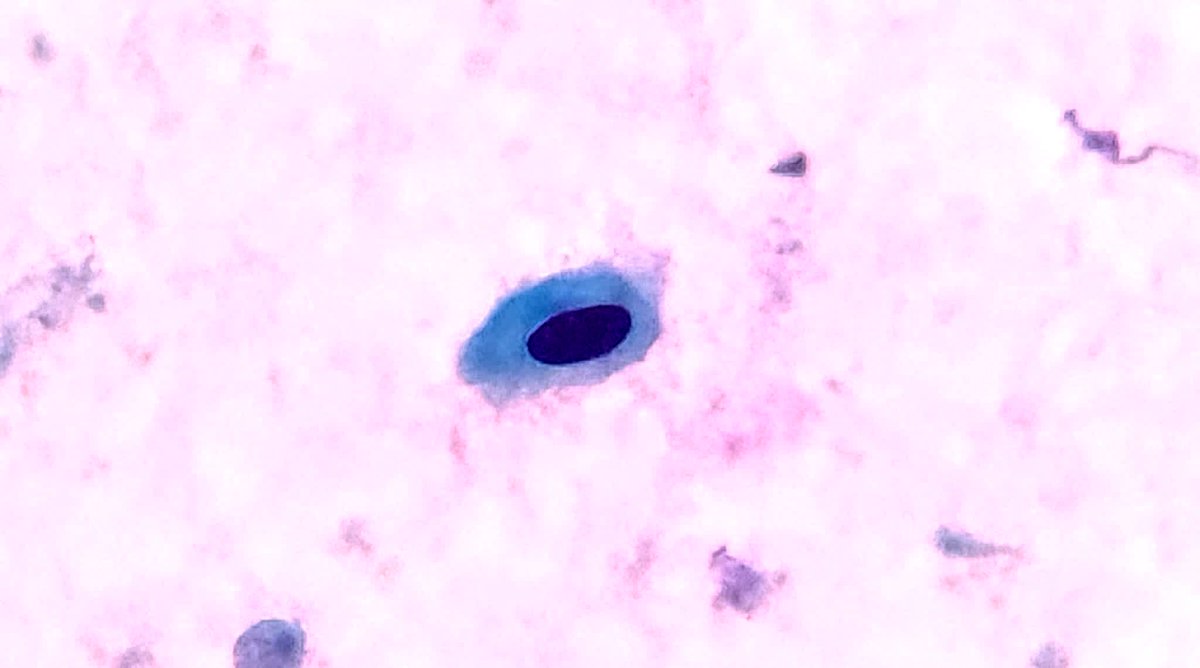 Vuelta a la Anatomía Patológica en 40 días tweet media