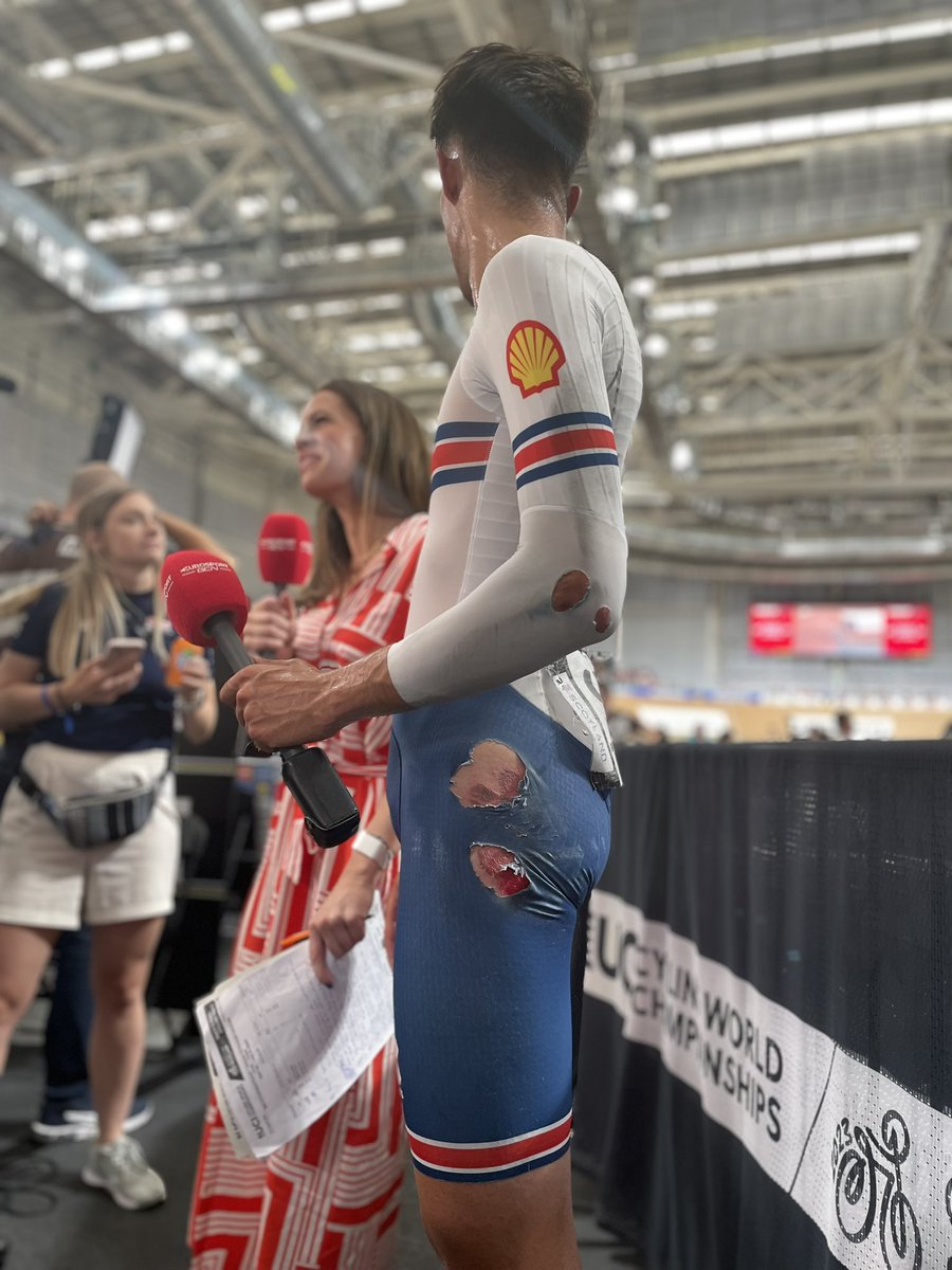 The battle wounds were worth it for @EthanVernon22 💪🥇 #Glasgow2023 | @BritishCycling