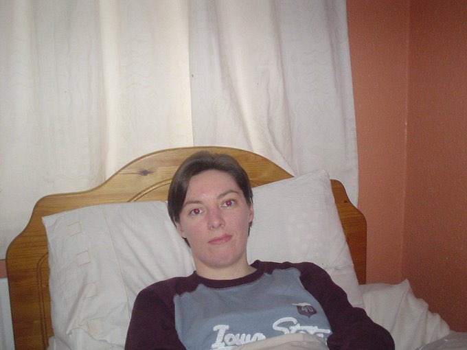 On #SevereMEday (Aug 8), I remember my friend Ruth Nolan from Glasnevin, Dublin who has spent 3 decades bedbound with #SevereME

For 14+ yrs she has had #VerySevereME:she's only able to have a few very short conversations & very little cognitive/mental stimulation☹️

#MEcfs #PwME
