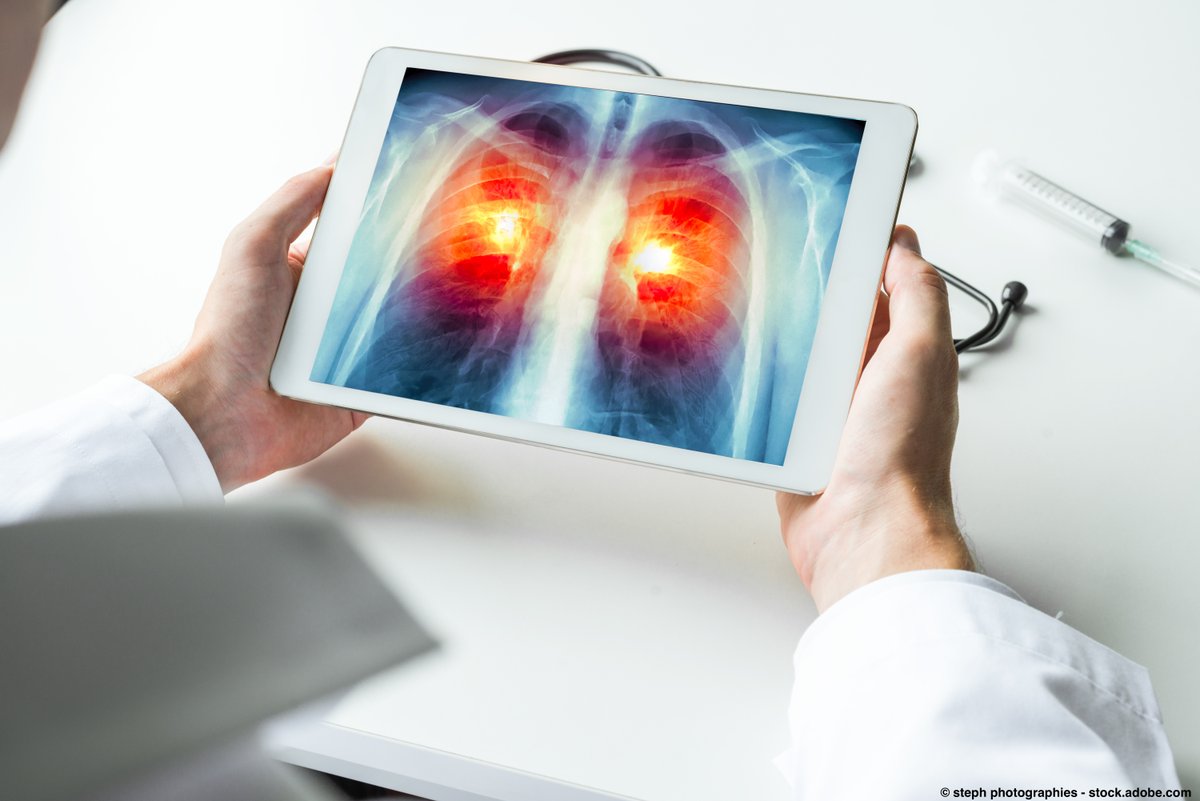 OncLive's tweet photo. TTFields, dual checkpoint inhibition, cancer vaccines, and microbiome manipulation may improve the trajectory of responses with immunotherapy in NSCLC, but more research and time are needed to determine their future role. @CUHKofficial #ILCC23 #lcsm https://t.co/80YuSHyKGn https://t.co/D7RTXeTyOZ
