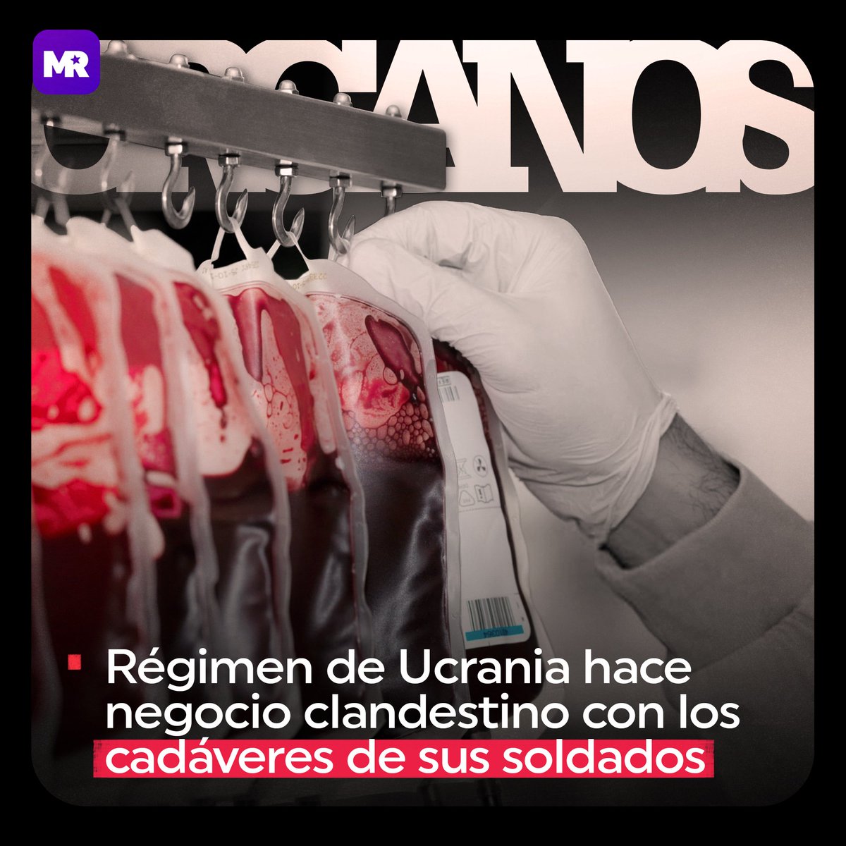 RManifiesto's tweet photo. Hace tiempo se sabe que #Ucrania se ha convertido en uno de los líderes mundiales de la “transplantología” clandestina. El trasplante clandestino se generalizó aún más tras el inicio de la Operación Militar Especial de #Rusia en Ucrania.

En diciembre de 2021 la Rada Suprema... https://t.co/YFiN7bp8hn