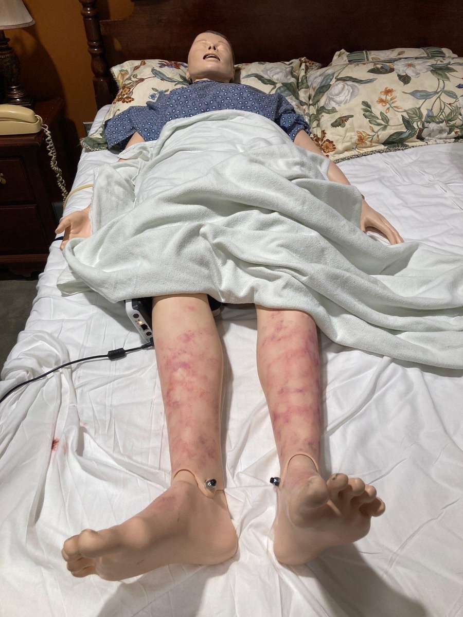 UCDavisSim's tweet photo. #Moulage is the use of makeup to create simulated injuries and symptoms of certain ailments. Check out the latest use of this technique by our #simulation specialist Aaron Lee. (Photo Credit: Aaron Lee.) #simtribe #MedEd https://t.co/O3y6UEg1uo