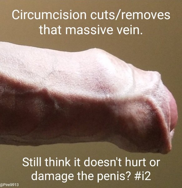 4skinFriendly's tweet photo. Fuck it I'm going to post an old pic, this time including my primary Twitter account. Feel free to share this image all you want. It does bring awareness to the subject after all. And follow my primary. I rarely use this account anymore and am more likely to talk to you there #i2 https://t.co/z1OhyMcdiq