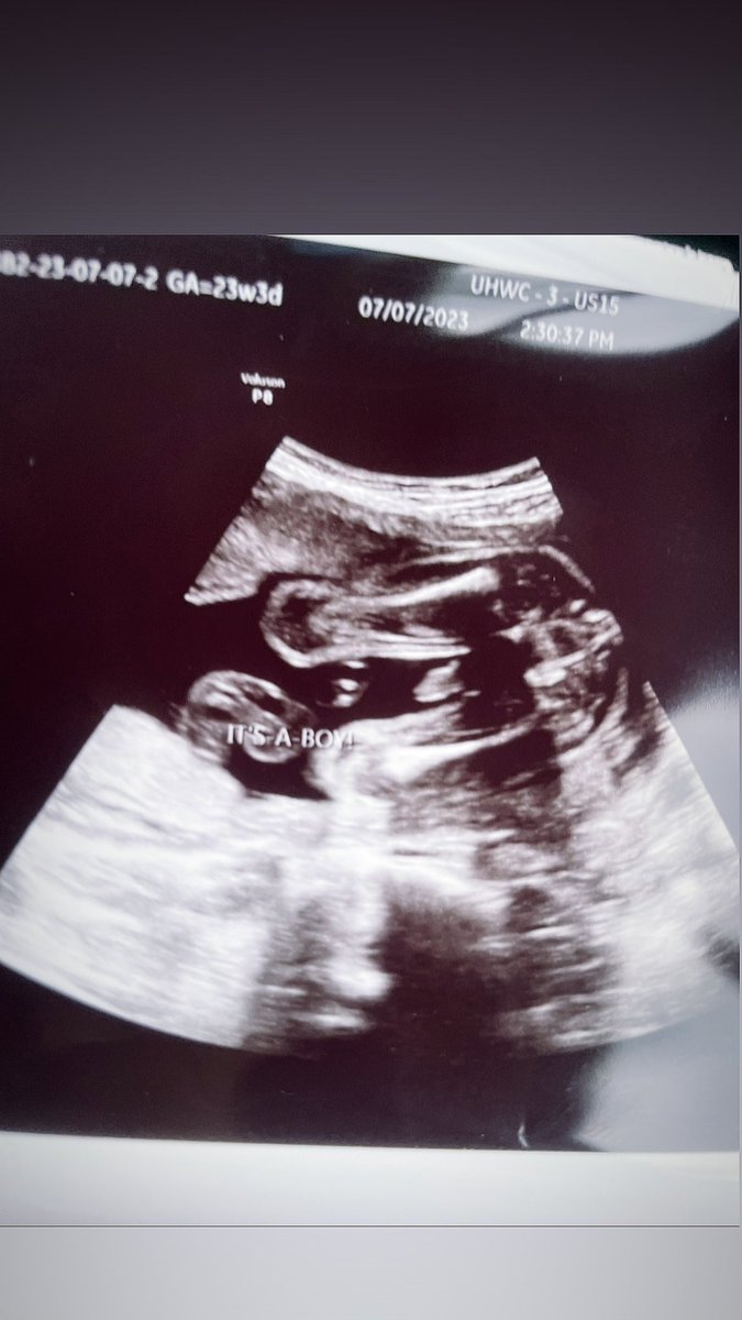 fineasskorean's tweet photo. Imma be a mommy 💙 https://t.co/sYUFnaOGvy