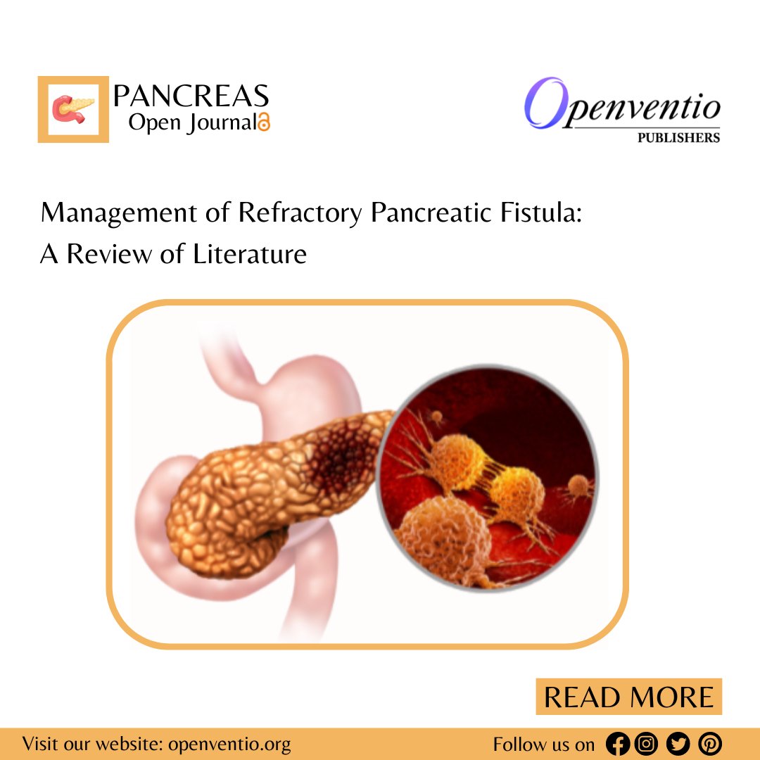 Management of Refractory Pancreatic Fistula: 
A Review of Literature by Hassan Aziz, MD[ISSN 2471-142X]

📖Read the full article here: rebrand.ly/75031d

✍Manuscript submission: bit.ly/3GNx61Q
.
.
.
#openventio #OpenAccess #peerreviewed #pancreatectomy