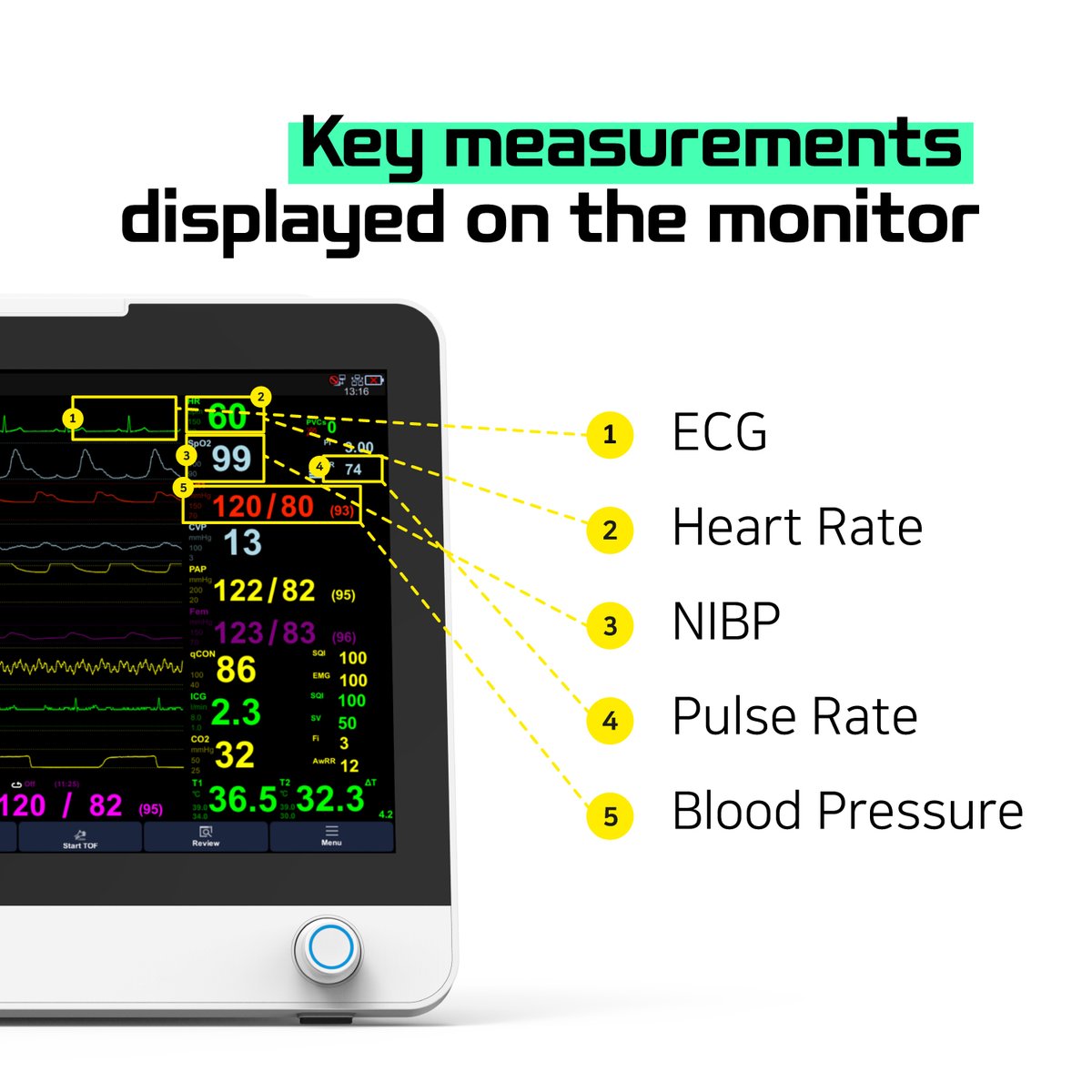 BionetHQ's tweet photo. Patientmonitor Part 2 ✌
#Bionet #Patientmonitor #Patientmonitoring #Patientmonitoringsystem #Patientmonitoringdevices #Medicalinformation #Healthcare #Medicaldevices https://t.co/cOYHYora41