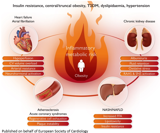 Cardiometabolic risk management: insights from an @escardio Cardiovascular Round Table bit.ly/3OsCE5M 

#EHJ #ESCYoung #ESCardioCRT @rladeiraslopes @ehj_ed