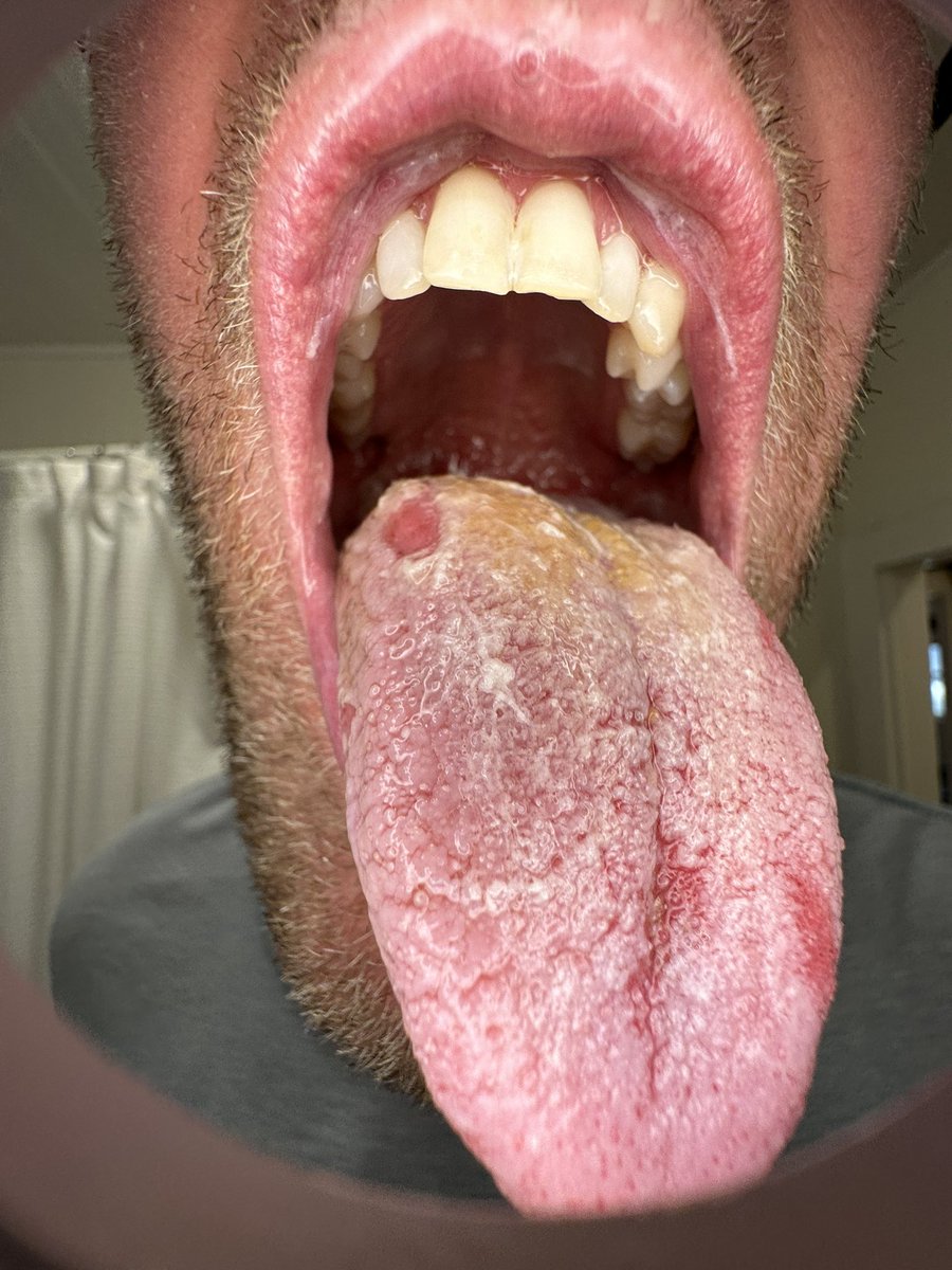 Brandon Gilles tweet media