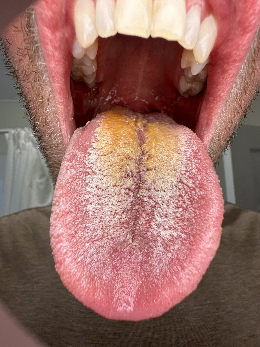 Brandon Gilles tweet media