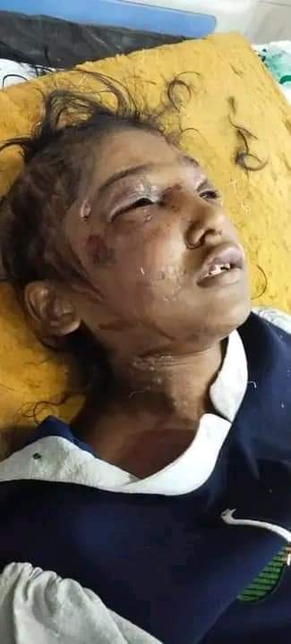 Hammad_Asghar95's tweet photo. Pakistan's women rights activists and leaders of @AuratMarch are still silent about the torture of 14 yr old girl by a civil judge's wife in Islamabad. #JusticeFor_Rizwana https://t.co/TtSibFBNMK