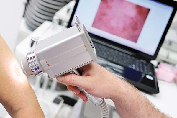 Je früher eine exakte #Hautkrebsdiagnose gestellt wird, desto besser sind die Heilungschancen. Die #Früherkennung von #Hautkrebs kann durch den Einsatz moderner Bildgebungstechniken und künstlicher Intelligenz (KI) noch weiter verbessert werden. ow.ly/JgSA50P8foc