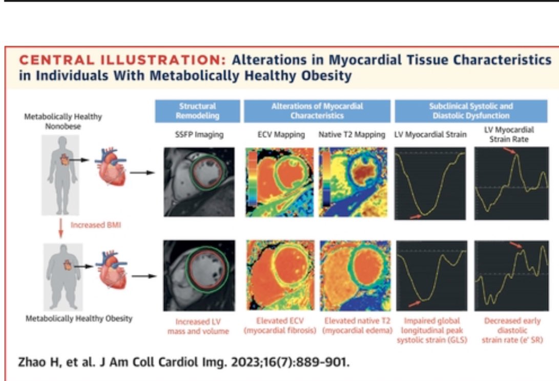⚠️Myocardial Tissue-Level Characteristics of Adults With Metabolically Healthy Obesity (MHO) vs metabolically unhealthy obesity (MUHO)

👉 myocardial fibrosis was 44%  in the MHO vs  71% in the MUHO group
👉MHO group had ⤵️ global longitudinal peak systolic and early diastolic