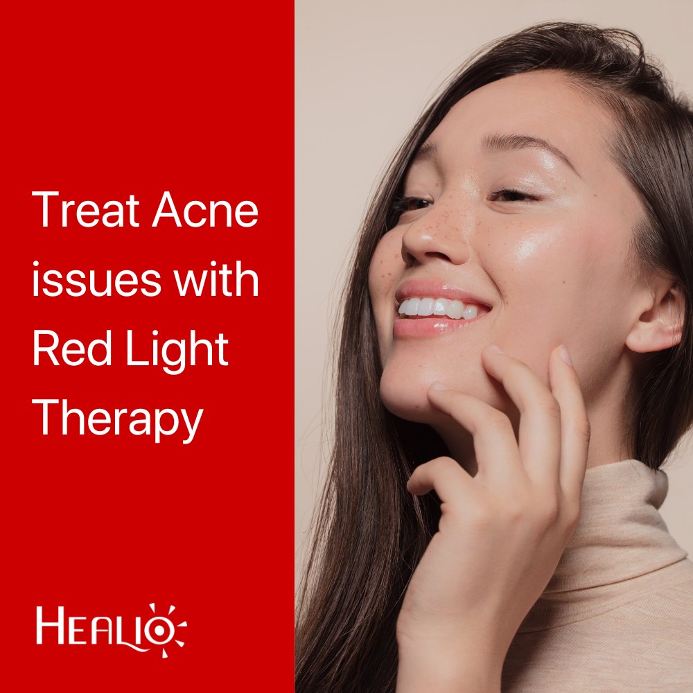 Healio_uk's tweet photo. #healio #healiouk #redlighttherapy https://t.co/X2NEO236xA