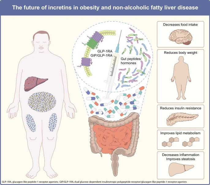 Daniel J Drucker (@danieljdrucker) on Twitter photo The latest in the <a href="/EASDnews/">EASD</a> <a href="/DiabetologiaJnl/">Diabetologia</a> forthcoming 2023 GL.P-1 issue #obesity #NAFLD #NASH <a href="/TinaVilsb/">Tina Vilsbøll</a> link.springer.com/article/10.100…. #Diabetes #T2D The latest in the <a href="/EASDnews/">EASD</a> <a href="/DiabetologiaJnl/">Diabetologia</a> forthcoming 2023 GL.P-1 issue #obesity #NAFLD #NASH <a href="/TinaVilsb/">Tina Vilsbøll</a> link.springer.com/article/10.100…. #Diabetes #T2D