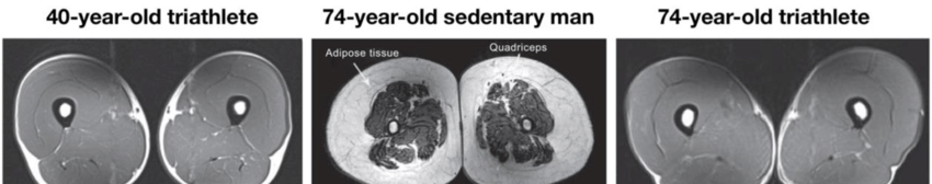 This is an MRI image of 3 people:

The top is a 40 year old triathlete.
The middle is a 74 year old sedentary person.
The bottom is a 70 year old triathlete.

The dark part is the muscle and the light part is the fat.

What you see is that a 70 year old may be able to retain the