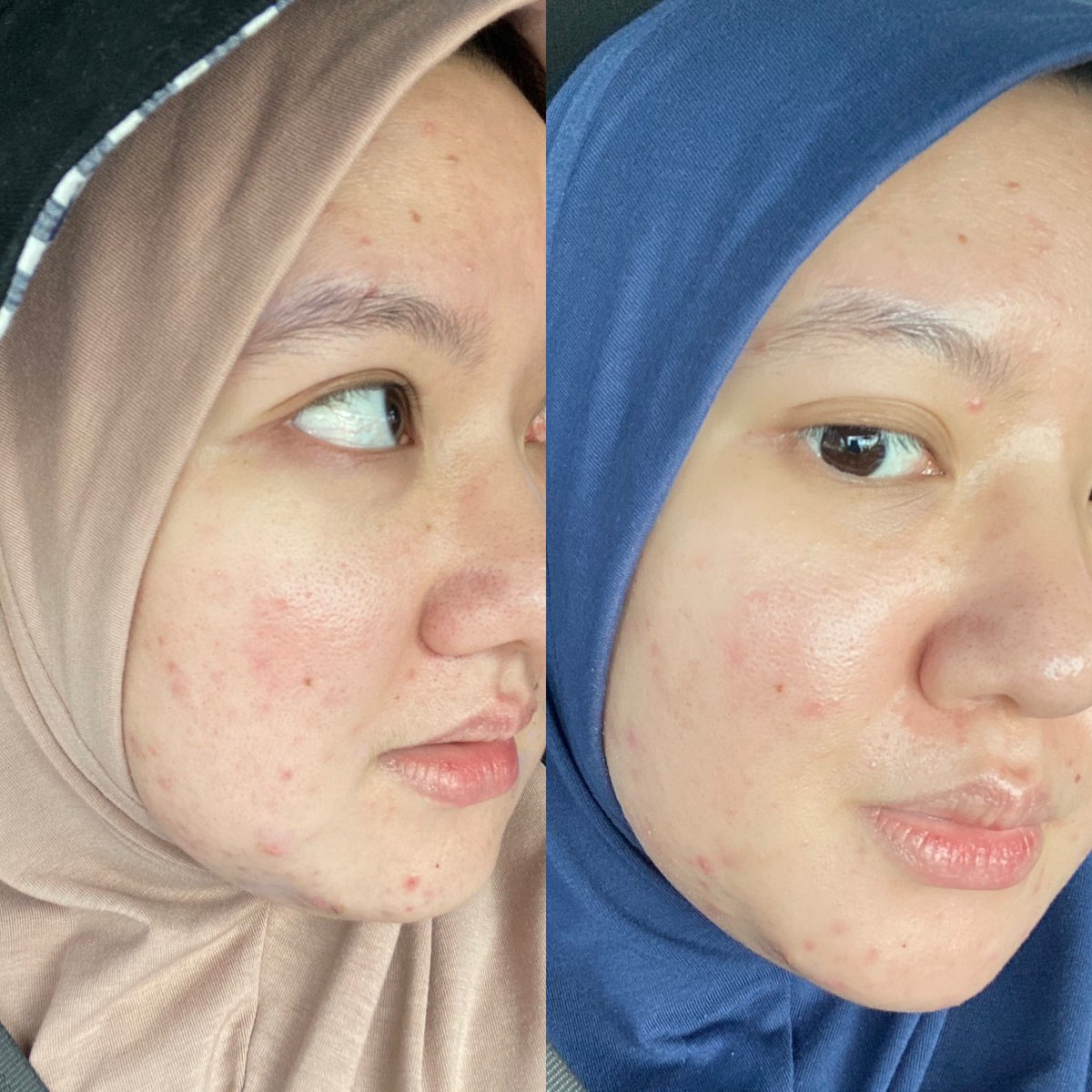 hsaytoc's tweet photo. Try laa Cynara. I mean.. 

Beza 9 hari jee… https://t.co/H8MsqKVYeD