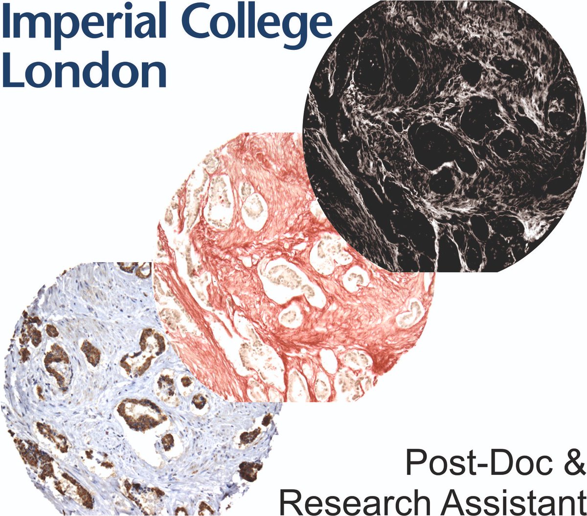 DAMIEN LEACH (@drdaleach) on Twitter photo We are looking for a post-doc and RA to work on an exciting project in prostate cancer investigating CAFs, ECM, spatial proteomics and more! @BevanLab <a href="/ImperialSandC/">Surgery and Cancer</a> Funded by <a href="/ProstateUK/">Prostate Cancer UK</a>
imperial.ac.uk/jobs/descripti…
imperial.ac.uk/jobs/descripti… We are looking for a post-doc and RA to work on an exciting project in prostate cancer investigating CAFs, ECM, spatial proteomics and more! @BevanLab <a href="/ImperialSandC/">Surgery and Cancer</a> Funded by <a href="/ProstateUK/">Prostate Cancer UK</a>
imperial.ac.uk/jobs/descripti…
imperial.ac.uk/jobs/descripti…