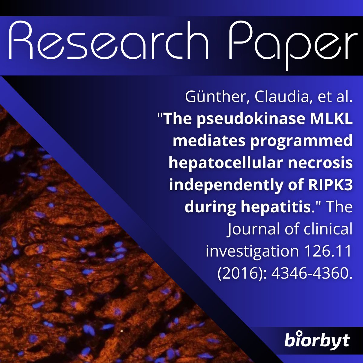This Friday is #worldhepatitisday. To mark the occasion, we've been checking out some of the work done by Biorbyt's partners on researching this crucial area. Here is just one example: jci.org/articles/view/…

#WHO #research #lifesciences #laboratory #bioscience