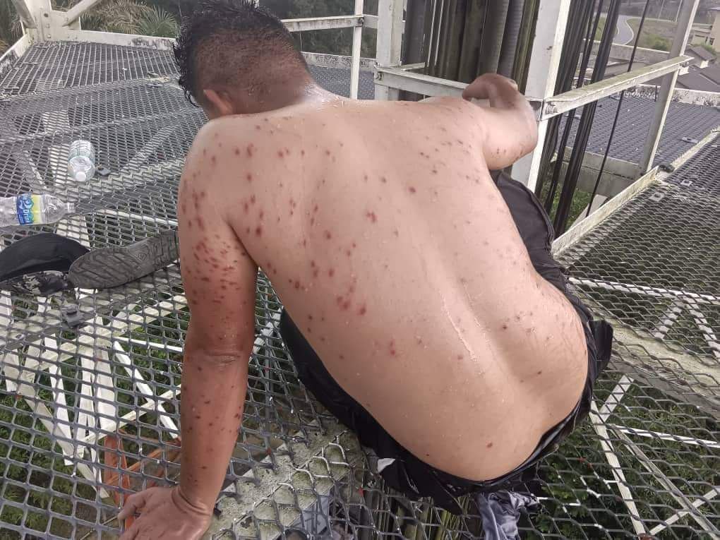 mynewshub's tweet photo. Juruteknik pencawang telekomunikasi maut disengat tebuan

KULIM – Seorang juruteknik maut selepas disengat tebuan ketika melakukan tugas di sebuah pencawang telekomunikasi setinggi 30 meter di Felda Gunung Bonsu, Karangan, di sini semalam.

Dalam kejadian pukul 1.30 petang, semalam, lelaki berusia 30 tahun itu meninggal dunia di wad kecemasan  Hospital Kulim kira-kira pukul 12.10 tengah malam semalam.

Ketua Polis Daerah Kulim, Superintendan Mohd. Redzuan Salleh berkata, kira-kira pukul 1.30 petang semalam  polis menerima laporan dari seorang lelaki yang memaklumkan rakan setuganya disengat tebuan.

Katanya mangsa yang berkerja  sebagai juruteknik telah di sengat tebuan semasa membuat kerja baik pulih kerosakan pencawang komunikasi di Felda Gunung Bongsu

“Pada awalnya mangsa telah di bawa ke Klinik Kesihatan Karangan untuk rawatan awal. Bagaimanapun mangsa didapati mengalami keadaan kesihatan yang lemah dan dibawa ke Hospital Kulim mengunakan ambulans untuk rawatan lanjut,” katanya dalam satu kenyataan hari ini.

Menurut Mohd. Redzuan, mangsa kemudian disahkan meninggal dunia kira-kira pukul 12.10 tengah malam semalam dan hasil bedah siasat mendapati punca kematian adalah disebabkan sengatan lebah.

“Tiada unsur jenayah dan kes disiasat sebagai kematian mengejut,jenazah mangsa telah diserahkan kepada waris dan akan dikembumikan di Alor Setar,” ujarnya. – KOSMO! ONLINE

Oleh AZAHAR HASHIM
27 Julai 2023, 5:30 pm

#Mynewshub
