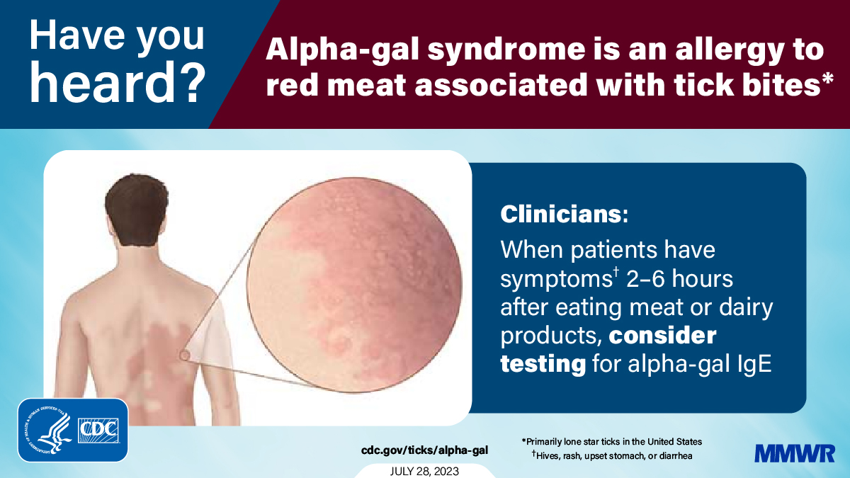 CDCgov's tweet photo. New report: Suspected cases of alpha-gal syndrome (AGS), a tick bite-associated allergic condition, have substantially increased since 2010. Between 2010-2022, CDC identified more than 110,000 people suspected of living with #AGS. Read more: https://t.co/B8fOpYfdsz https://t.co/ZqEYb79KP0
