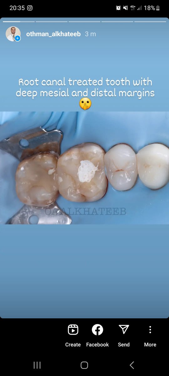 Dr.Othman Alkhateeb tweet media