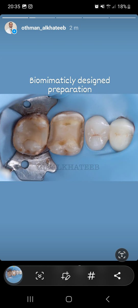 Dr.Othman Alkhateeb tweet media