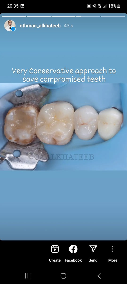 Dr.Othman Alkhateeb tweet media