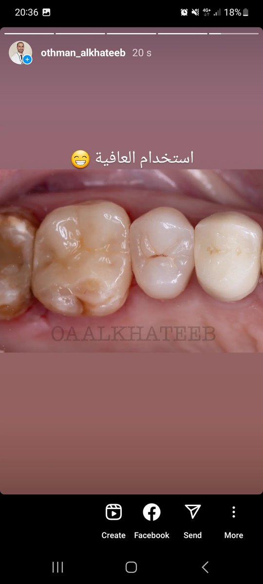 Dr.Othman Alkhateeb tweet media